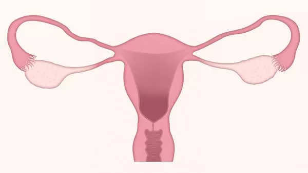 تجارب النساء بعد استئصال الرحم
